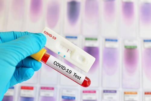 kielce wiadomości Mniów ma testy na koronawirusa, tylko chętnych do badań brak